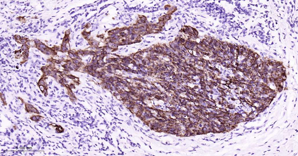 人Keratin 7即用型免疫组化试剂盒-IHC0604H